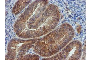 Image no. 6 for anti-Mannose Phosphate Isomerase (MPI) antibody (ABIN1499545) (MPI antibody)