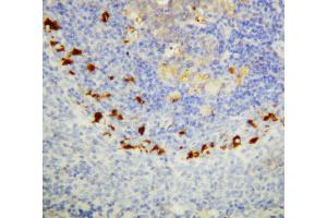 Anti-SOCS1 antibody, IHC(P) IHC(P): Rat Spleen Tissue (SOCS1 antibody  (C-Term))