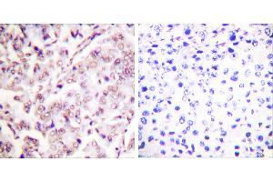 P-peptide - + (ETS1 antibody  (pThr38))