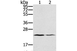 Western Blot analysis of Human normal right lung and normal left lung tissue using EDN2 Polyclonal Antibody at dilution of 1:600 (Endothelin 2 antibody)