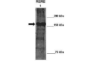 Lanes :  Lane 1: 10ug mouse ATN2 transfected Drosophila extract   Primary Antibody Dilution :   1:100    Secondary Antibody :  Anti-rabbit-HRP   Secondary Antibody Dilution :   1:2000   Gene Name :  RERE   Submitted by :  Manolis Fanto, King's College London