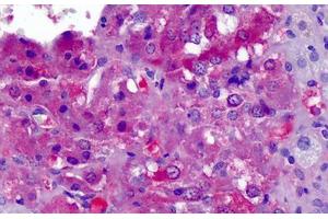 Human Adrenal: Formalin-Fixed, Paraffin-Embedded (FFPE) (APOA2 antibody  (AA 1-100))