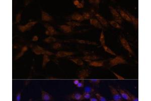 Immunofluorescence analysis of C6 cells using CD44 Polyclonal Antibody at dilution of 1:100. (CD44 antibody)