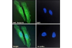 ABIN185127 Immunofluorescence analysis of paraformaldehyde fixed HeLa cells, permeabilized with 0. (Pleckstrin antibody  (C-Term))