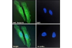ABIN185127 Immunofluorescence analysis of paraformaldehyde fixed HeLa cells, permeabilized with 0.
