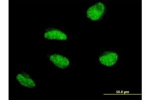 Immunofluorescence of monoclonal antibody to MSH5 on HeLa cell. (MSH5 antibody  (AA 736-835))