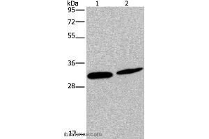 Western blot analysis of Mouse skin tissue and Hela cell, using GJB4 Polyclonal Antibody at dilution of 1:200 (GJB4 antibody)