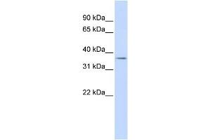 WB Suggested Anti-TRIM69 Antibody Titration:  0. (TRIM69 antibody  (N-Term))
