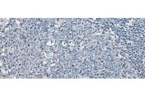 Immunohistochemistry of paraffin-embedded Human tonsil tissue using LASP1 Polyclonal Antibody at dilution of 1:35(x200) (LASP1 antibody)