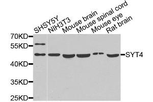 Western blot analysis of extracts of various cell lines, using SYT4 antibody (ABIN5975174) at 1/1000 dilution.