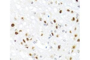 Immunohistochemistry of paraffin-embedded Rat brain using GATA2 Polyclonal Antibody at dilution of 1:100 (40x lens). (GATA2 antibody)