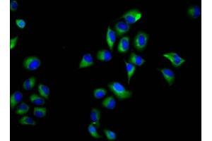 Immunofluorescence staining of Hela cells with ABIN7161019 at 1:66, counter-stained with DAPI. (NOXO1 antibody  (AA 304-376))