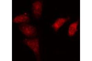 ABIN6274164 staining HeLa cells by IF/ICC.
