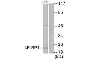 Western blot analysis of extracts from COS7 cells, treated with EGF (200 ng/mL, 30 mins), using 4E-BP1 (Ab-69) antibody. (eIF4EBP1 antibody  (Thr70))