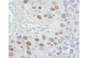 Immunohistochemistry (IHC) image for anti-Phosphate Cytidylyltransferase 1, Choline, alpha (PCYT1A) (AA 1-50) antibody (ABIN7454584) (PCYT1A antibody  (AA 1-50))