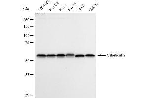 Western blotting analysis using Calreticulin antibody (ABIN7797853). (Recombinant Calreticulin antibody)