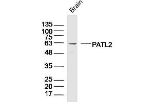 PATL2 anticorps  (AA 301-400)