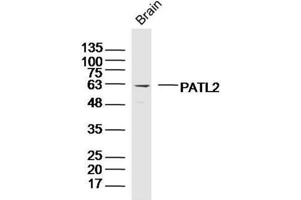 PATL2 anticorps  (AA 301-400)
