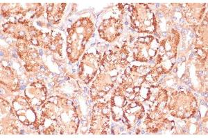 Immunohistochemistry of paraffin-embedded Mouse kidney using MAP2K3 Polyclonal Antibody at dilution of 1:100 (40x lens). (MAP2K3 antibody)