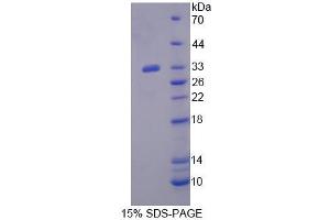 SDS-PAGE analysis of Human XPO6 Protein. (Exportin 6 Protein (XPO6))