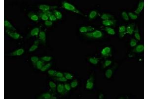 Immunofluorescence staining of Hela cells with ABIN7171577 at 1:100, counter-stained with DAPI. (TAF15 antibody  (AA 93-206))
