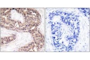 Immunohistochemistry (IHC) image for anti-GTPase Activating Protein (SH3 Domain) Binding Protein 1 (G3BP1) (AA 199-248) antibody (ABIN1532878)