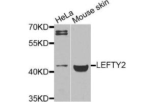Western blot analysis of extracts of various cell lines, using LEFTY2 antibody (ABIN6003578) at 1/1000 dilution. (LEFTY2 antibody)