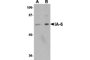 Western blot analysis of IA-6 in rat thymus tissue lysate with IA-6 antibody at (A) 1 and (B) 2 µg/mL. (INSM2 antibody  (C-Term))