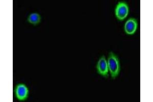 Immunofluorescent analysis of HepG2 cells using ABIN7158768 at dilution of 1:100 and Alexa Fluor 488-congugated AffiniPure Goat Anti-Rabbit IgG(H+L) (GAA antibody  (AA 601-952))