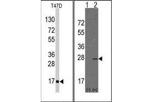 Image no. 1 for anti-Anterior Gradient Homolog 2 (Xenopus Laevis) (AGR2) (N-Term) antibody (ABIN358783) (AGR2 antibody  (N-Term))