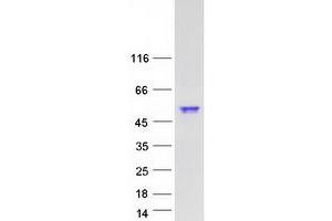 Validation with Western Blot (SYT6 Protein (Myc-DYKDDDDK Tag))