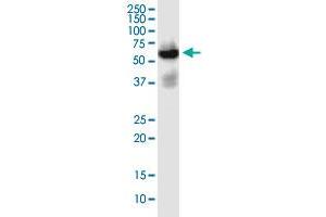 SLC22A2 monoclonal antibody (M02), clone 1E3.