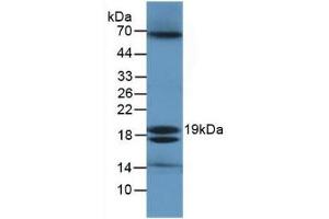 Detection of ECO in Ecoli Cells using Polyclonal Antibody to Ecotin (ECO) (Ecotin (AA 21-162) antibody)