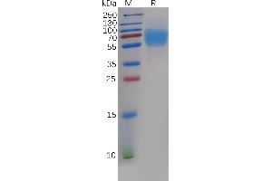 Cytotoxic and Regulatory T Cell Molecule (CRTAM) (AA 18-287) protein (His tag)
