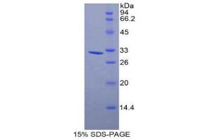 SDS-PAGE (SDS) image for Myosin Light Chain Kinase 3 (MYLK3) (AA 488-750) protein (His tag) (ABIN2121718)