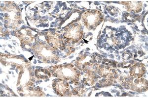 Human kidney; RGS20 antibody - middle region in Human kidney cells using Immunohistochemistry (RGS20 antibody  (all Isoforms, Middle Region))