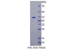 SDS-PAGE analysis of Mouse CES1 Protein. (CES1 Protein)