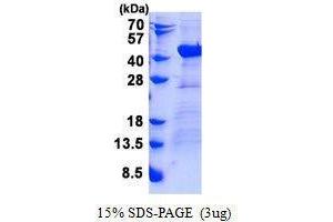 Figure annotation denotes ug of protein loaded and % gel used. (DNAJB4 Protein)