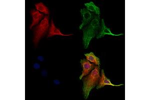ABIN6260408 and ABIN6273204 staining Hela cells by IF/ICC. (CALCOCO2 antibody  (Internal Region))