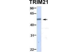 Hum. (TRIM21 antibody  (N-Term))