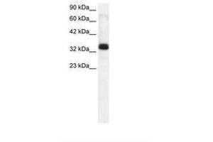 Image no. 1 for anti-TIA1 Cytotoxic Granule-Associated RNA Binding Protein-Like 1 (TIAL1) (C-Term) antibody (ABIN202371) (TIAL1 antibody  (C-Term))