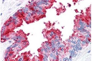 Human Prostate: Formalin-Fixed, Paraffin-Embedded (FFPE) (ADAM20 antibody  (Internal Region))