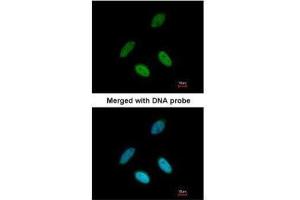 ICC/IF Image Immunofluorescence analysis of paraformaldehyde-fixed HeLa, using TAP, antibody at 1:200 dilution. (NXF1 antibody  (C-Term))