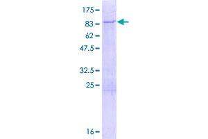 LARP6 Protein (AA 1-491) (GST tag)