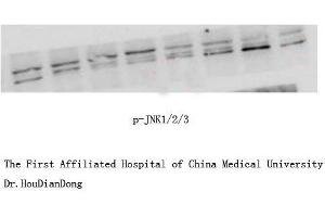 Western Blot (WB) analysis: Please contact us for more details. (JNK antibody  (pThr183, pTyr185))