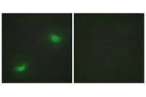 Immunofluorescence analysis of HepG2 cells, using DUSP16 antibody. (DUSP16 antibody)