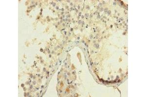 HMGB4 antibody  (AA 1-186)