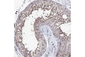 Immunohistochemical staining of human testis with PUS3 polyclonal antibody  shows moderate cytoplasmic positivity in cells in seminiferus ducts at 1:50-1:200 dilution.