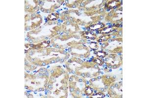 Immunohistochemistry of paraffin-embedded Mouse kidney using FBXO21 Rabbit pAb (ABIN7267085) at dilution of 1:100 (40x lens). (FBXO21 antibody  (AA 440-621))
