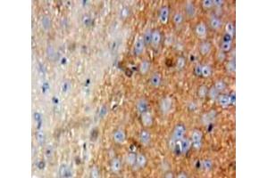 #VALUE! (TLN1 antibody  (AA 2293-2536))